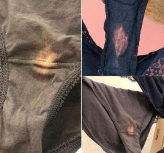 This is what it means if you find a “bleach” spot on your underwear